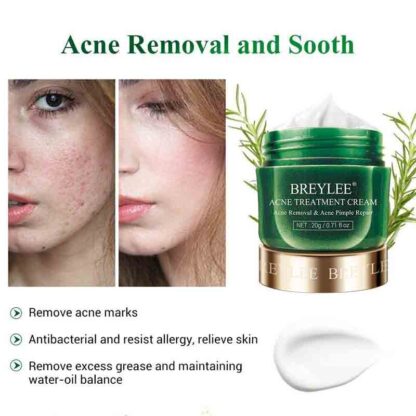 BREYLEE Acne Treatment Cream Anti Acne Face Cream