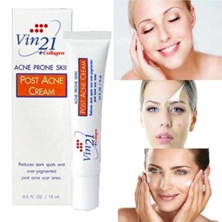 Vin 21 Anti Acne Cream